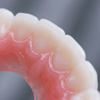 Close-up of silicone tooth cover material texture